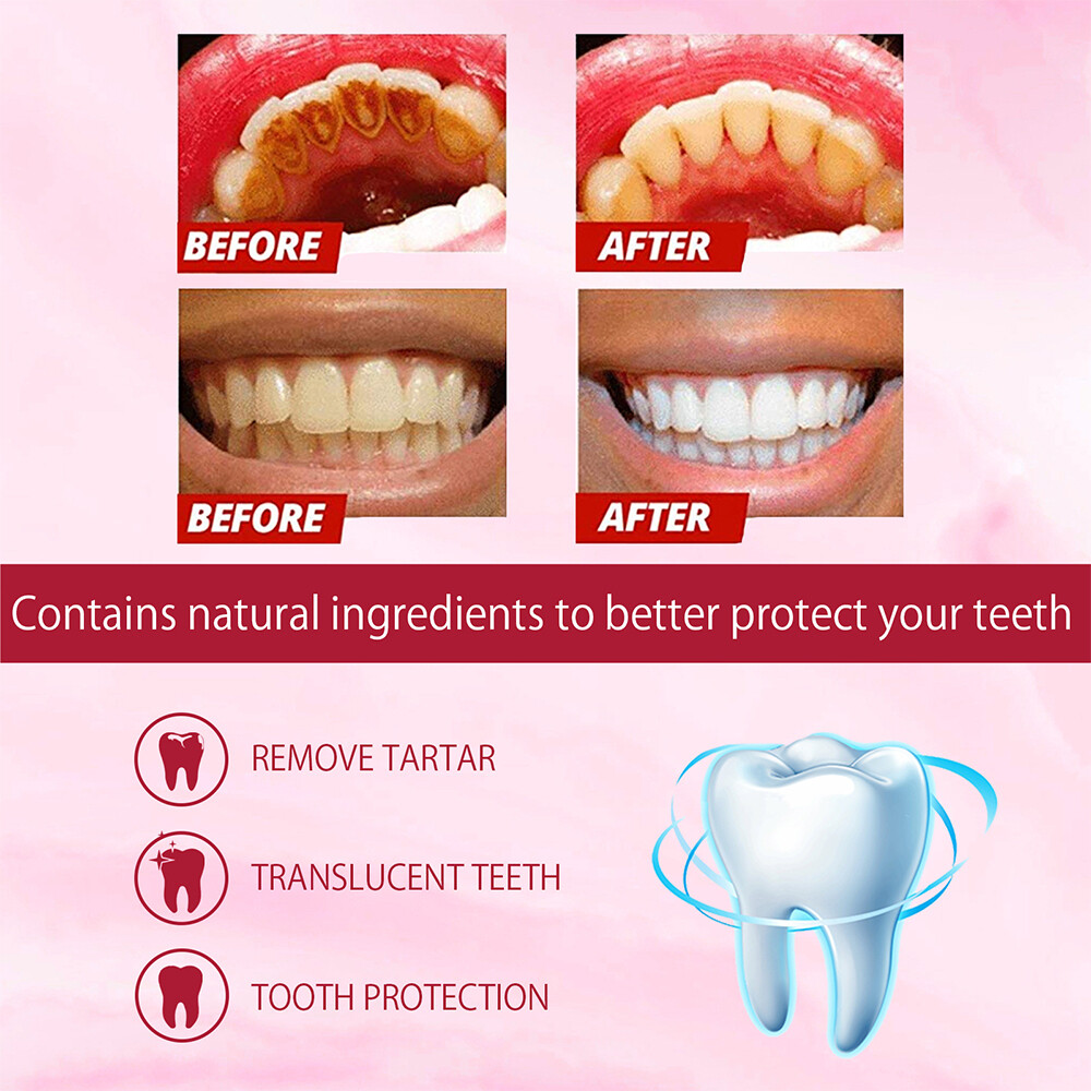 Sp-6 Probiotics Whitening Toothpaste Brightening & Breath Removing Toothpaste US