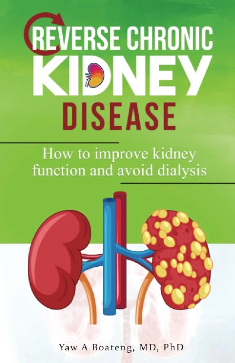 Reverse Chronic Kidney Disease: How to Improve Kidney Function and Avoid Dialysi