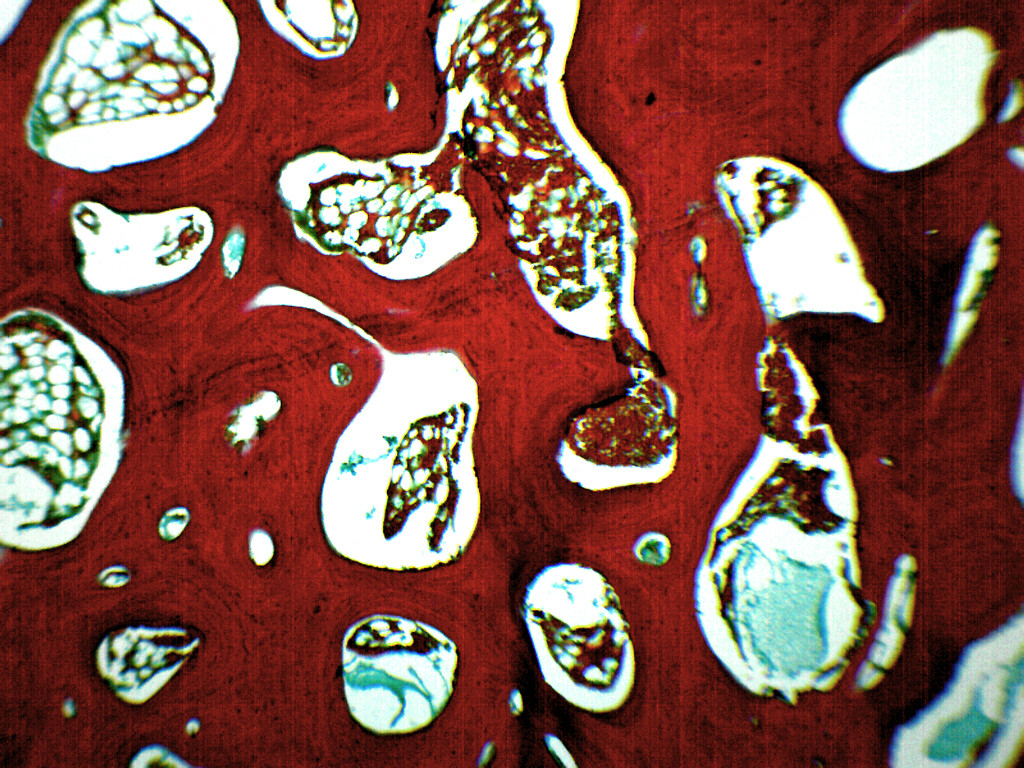 Spongy Bone Section (Mammal), Prepared Microscope Slide - 75x25mm - Eisco Labs