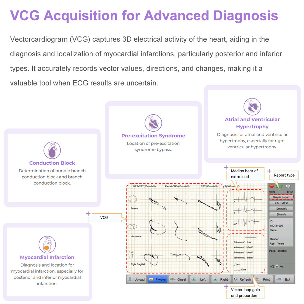 12 channel ECG Machine with interpretation for advisory diagnosis FDA approved