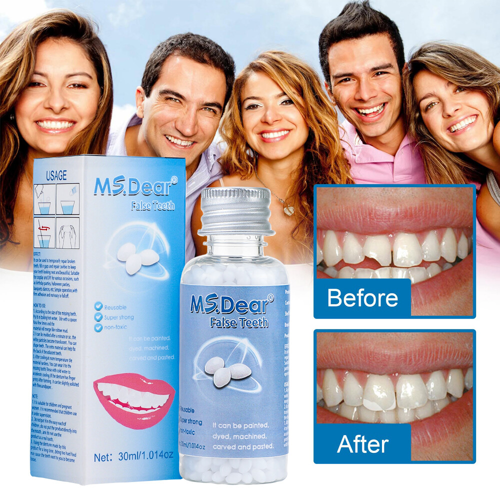 Tooth Solid Gel Temporary Repair Kit Moldable Thermal Fitting Bead Teeth 30ml