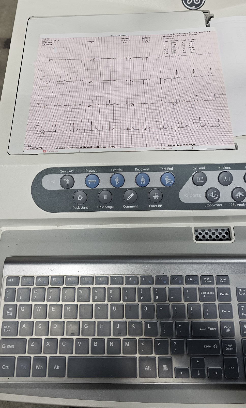 GE Case Stress System Windows 10 Ver.6.73