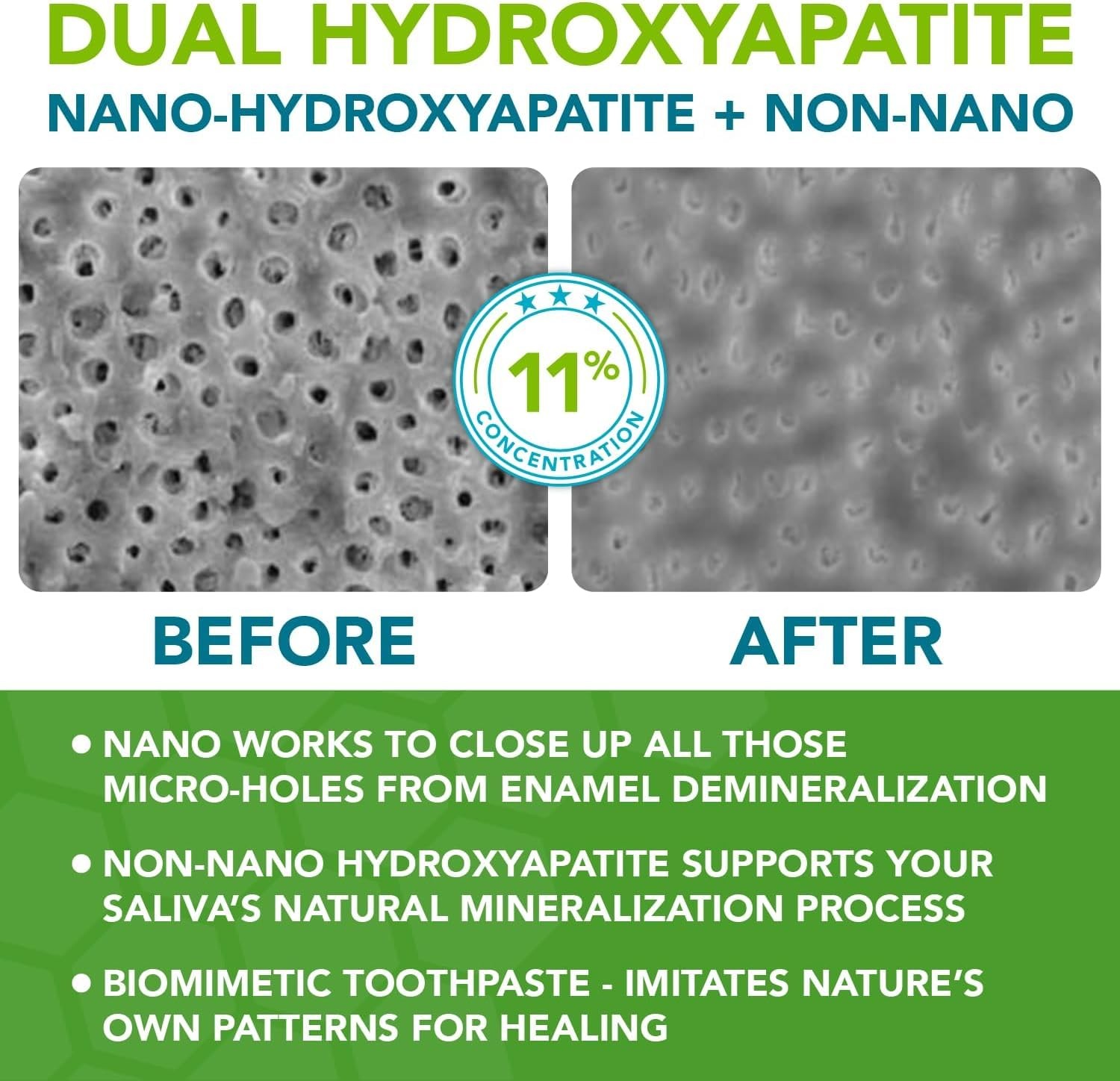 Nano hydroxyapatite Toothpaste Fluoride Free | Pro Remineralizing Toothpaste ...