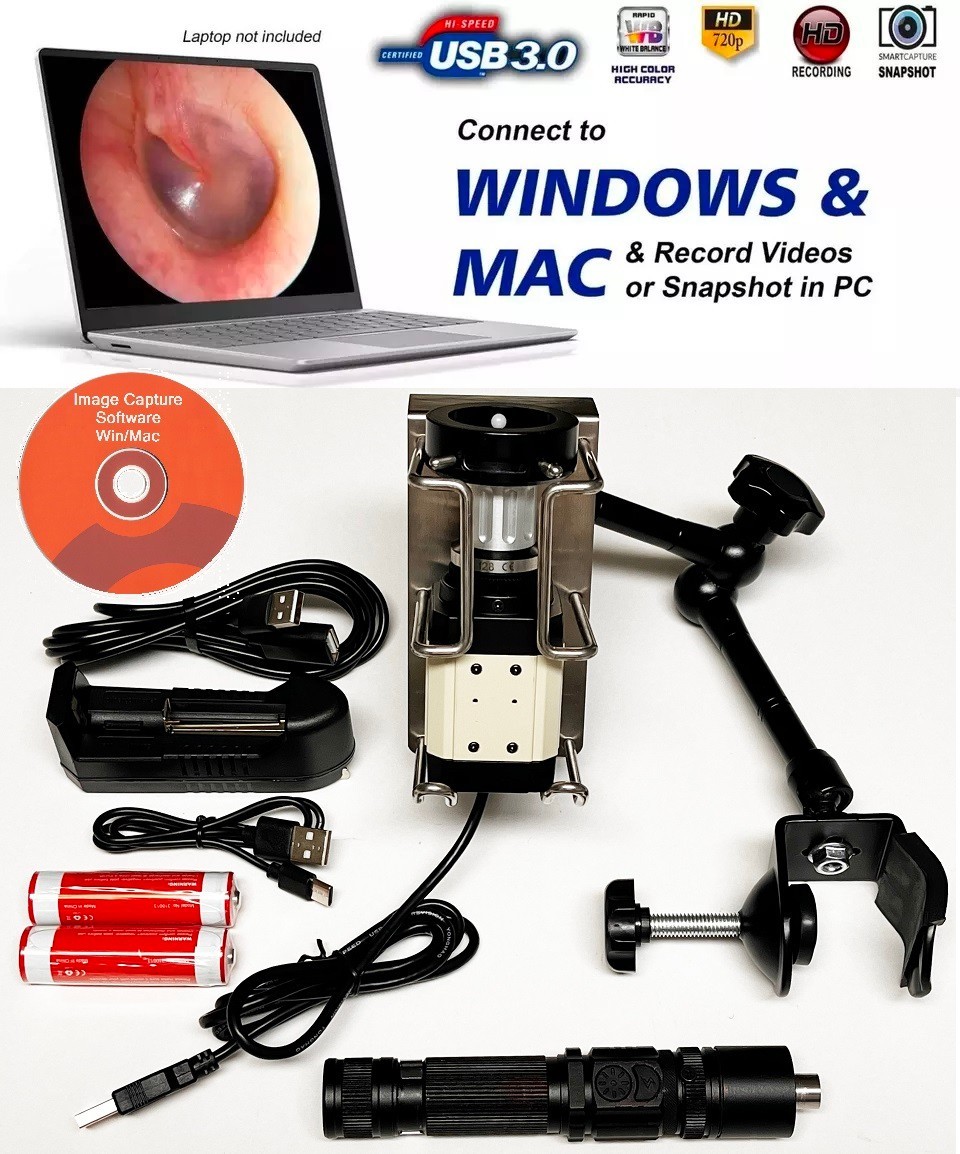 Rigid Endoscope Endoscopy Sinuscope HD USB Camera+Coupler+LED Light Source+Mount