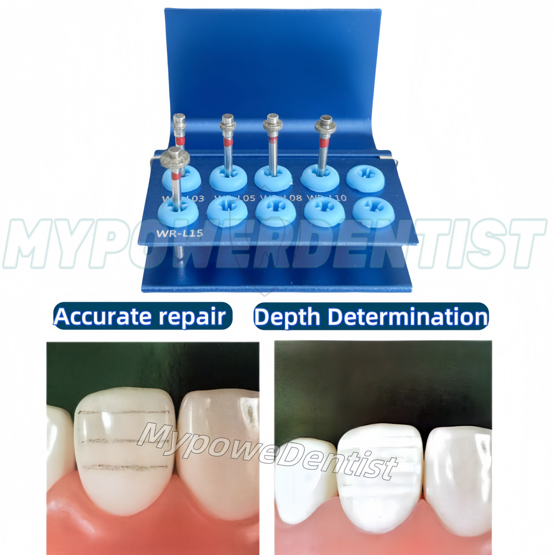 Dental Front Teeth Single Wheel Depth Determination Needle Diamond Sand Bur Set
