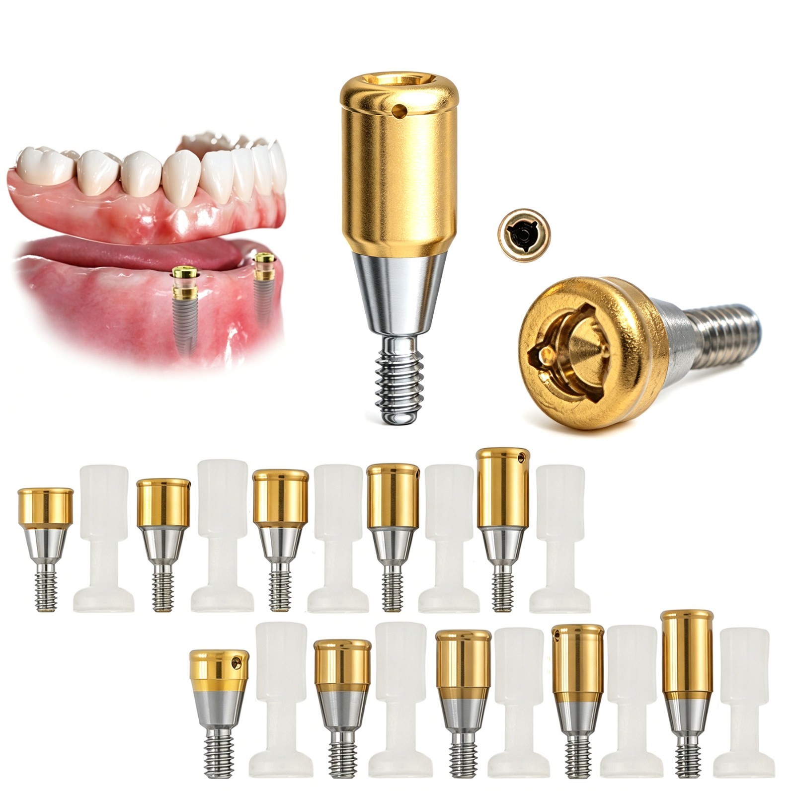 Locator Overdenture Abutment Fits Nobel Active Conical Connection NP/RP Platform
