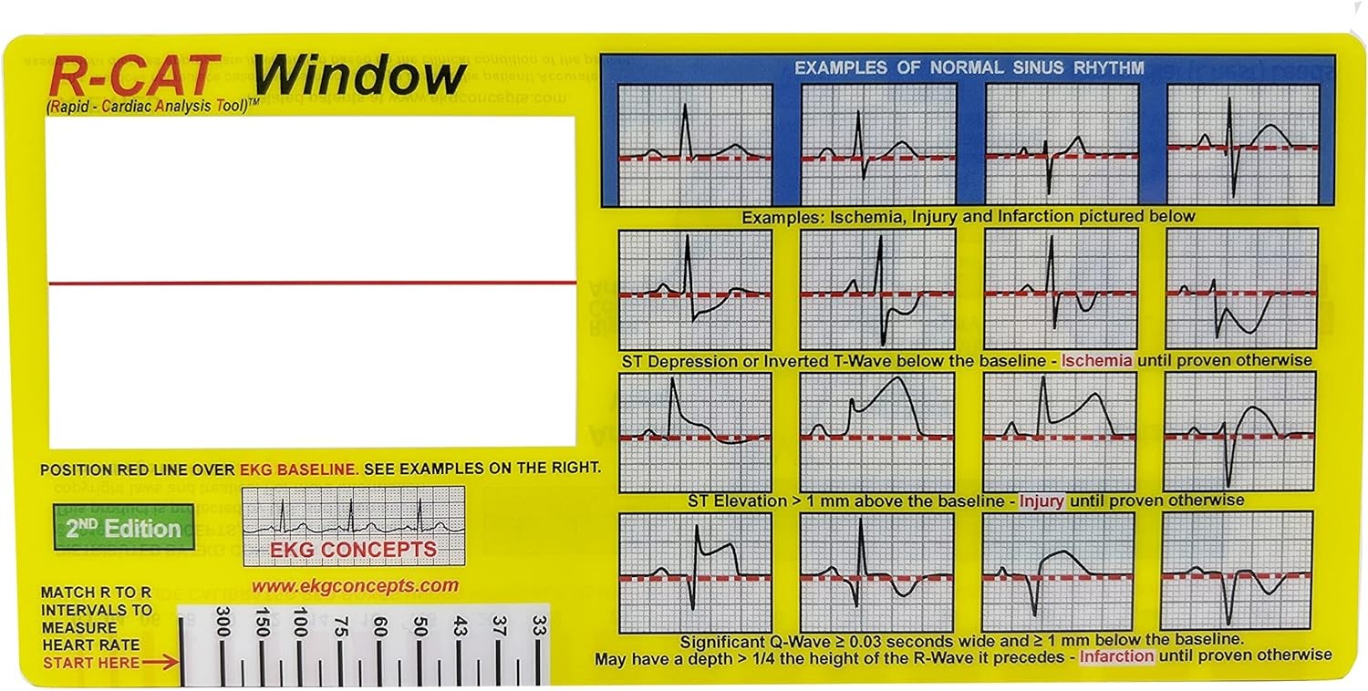 R-CAT EKG Window 2nd Edition Yellow