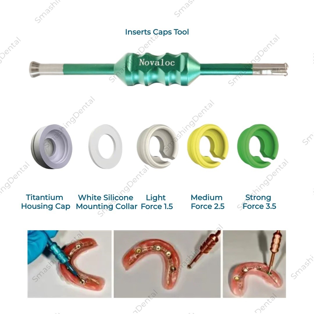 Novaloc Retention Insert Caps Dental PEEK Cap Matrix Titanium Housing Caps Mount