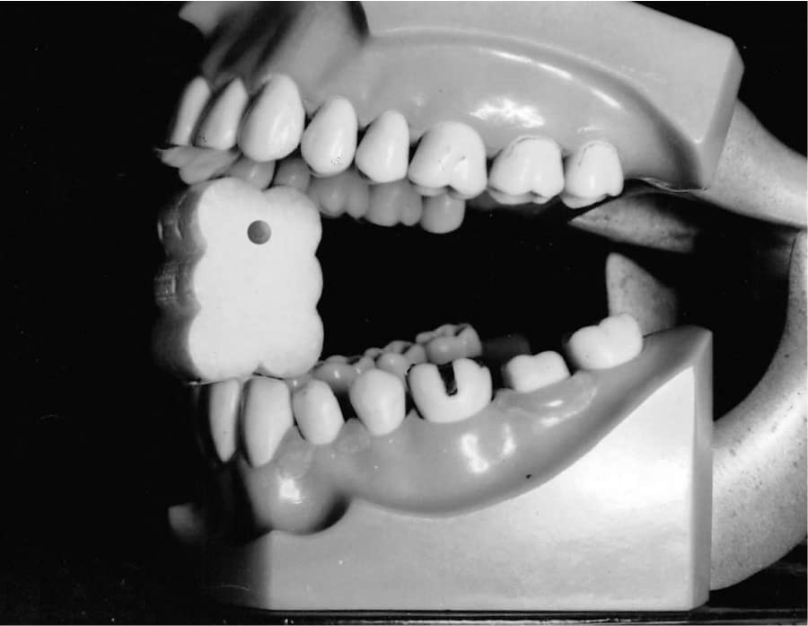 EZ Prop ­® Disposable Mouth Prop - 100 Count