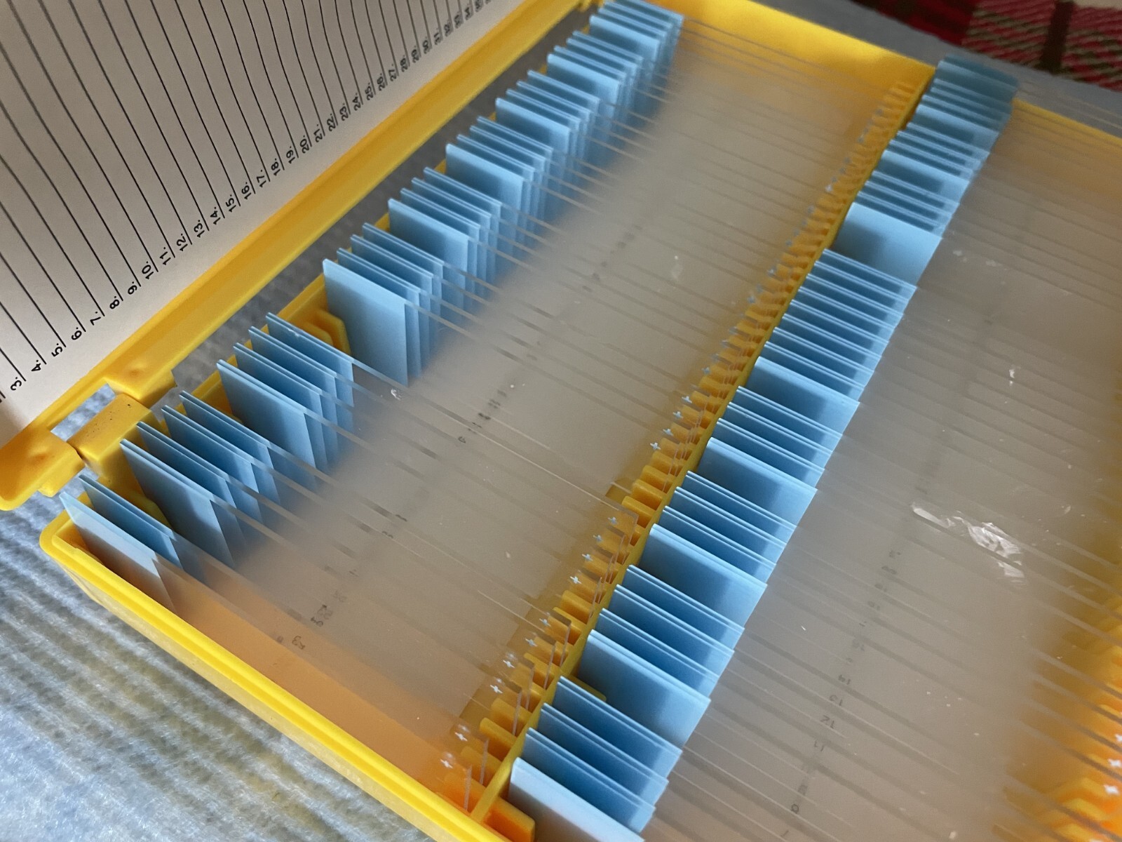 Four Microscope storage boxes with mouse tissues slides, 14,15,16,17
