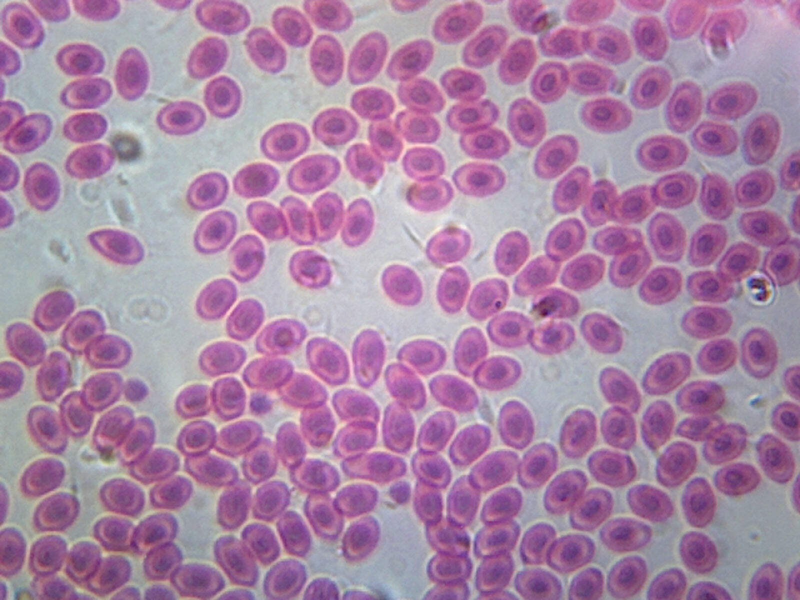 Frog Blood; Smear