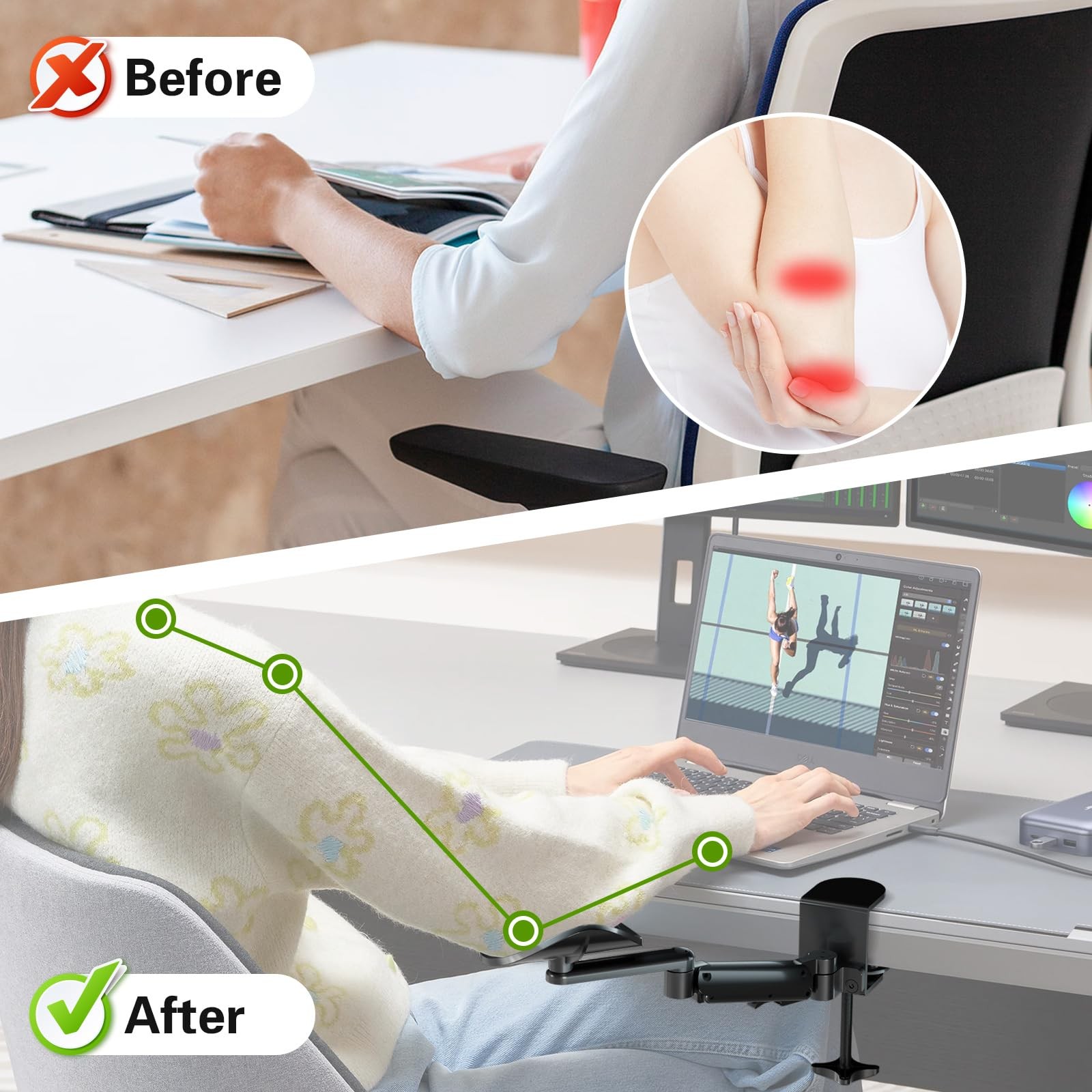 Universal Clamp-on Adjustable Arm Rest, Ergonomic 360° Rotating Elbow Rest Pa...
