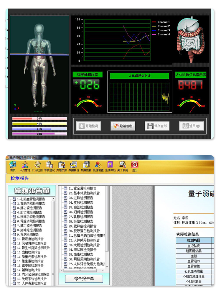 2025 Newest Professional Quantum Analyzer With 52 Reports-English & Spanish