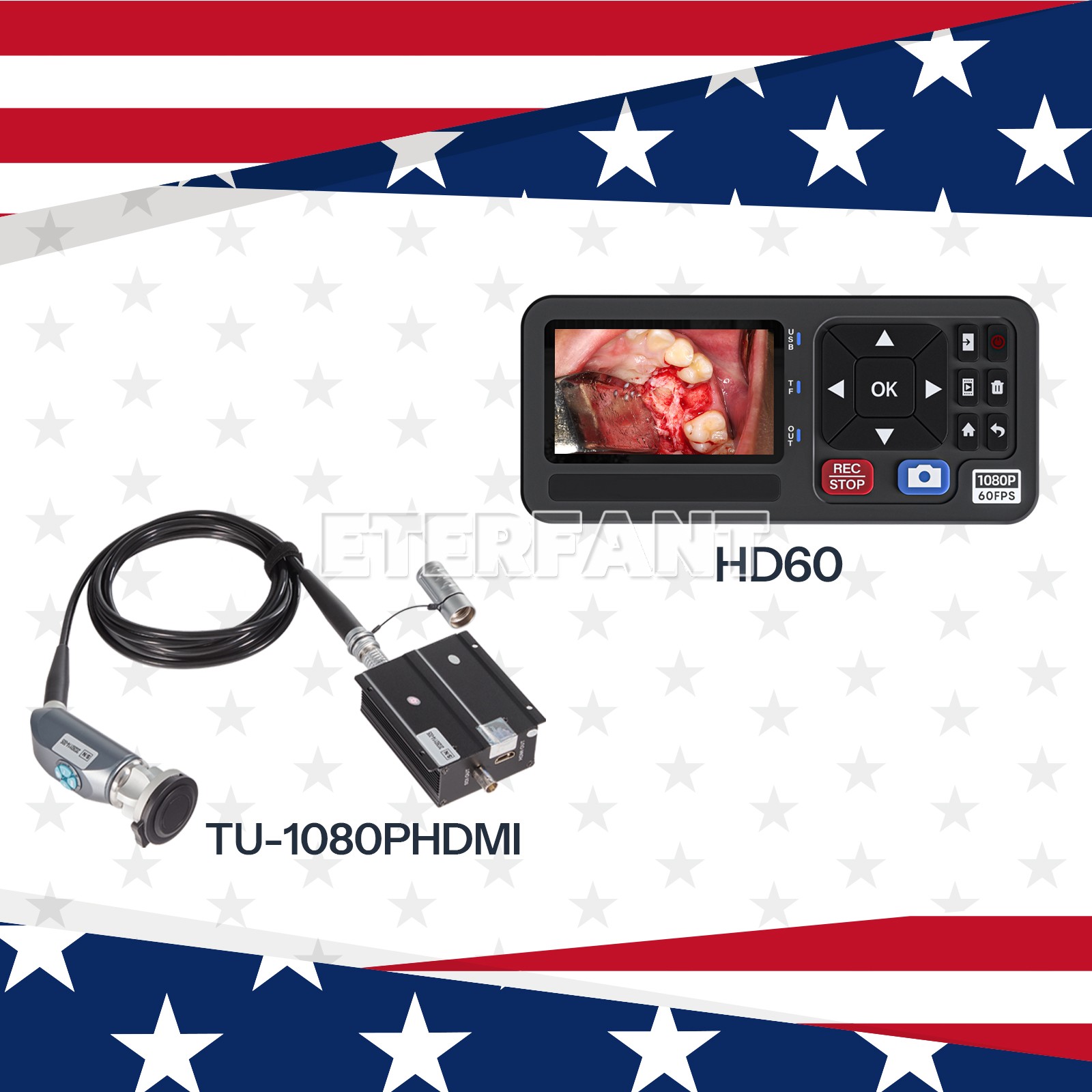 Full HD ENT Endoscopy Laparoscopic Camer/Medical Surgical Recorder Captur US