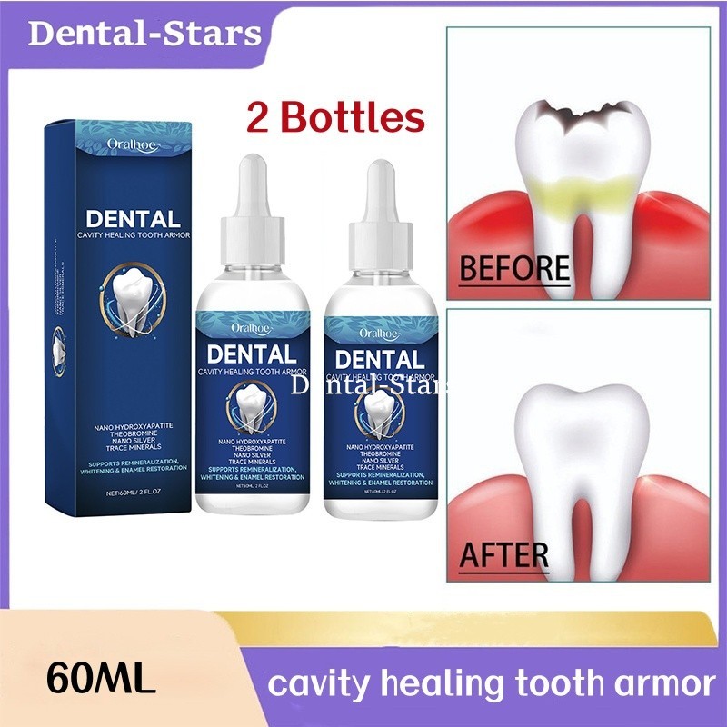 2Pcs Dental Enamel Repair Liquid Cavity Healing Armor Repair Teeth Care Solution