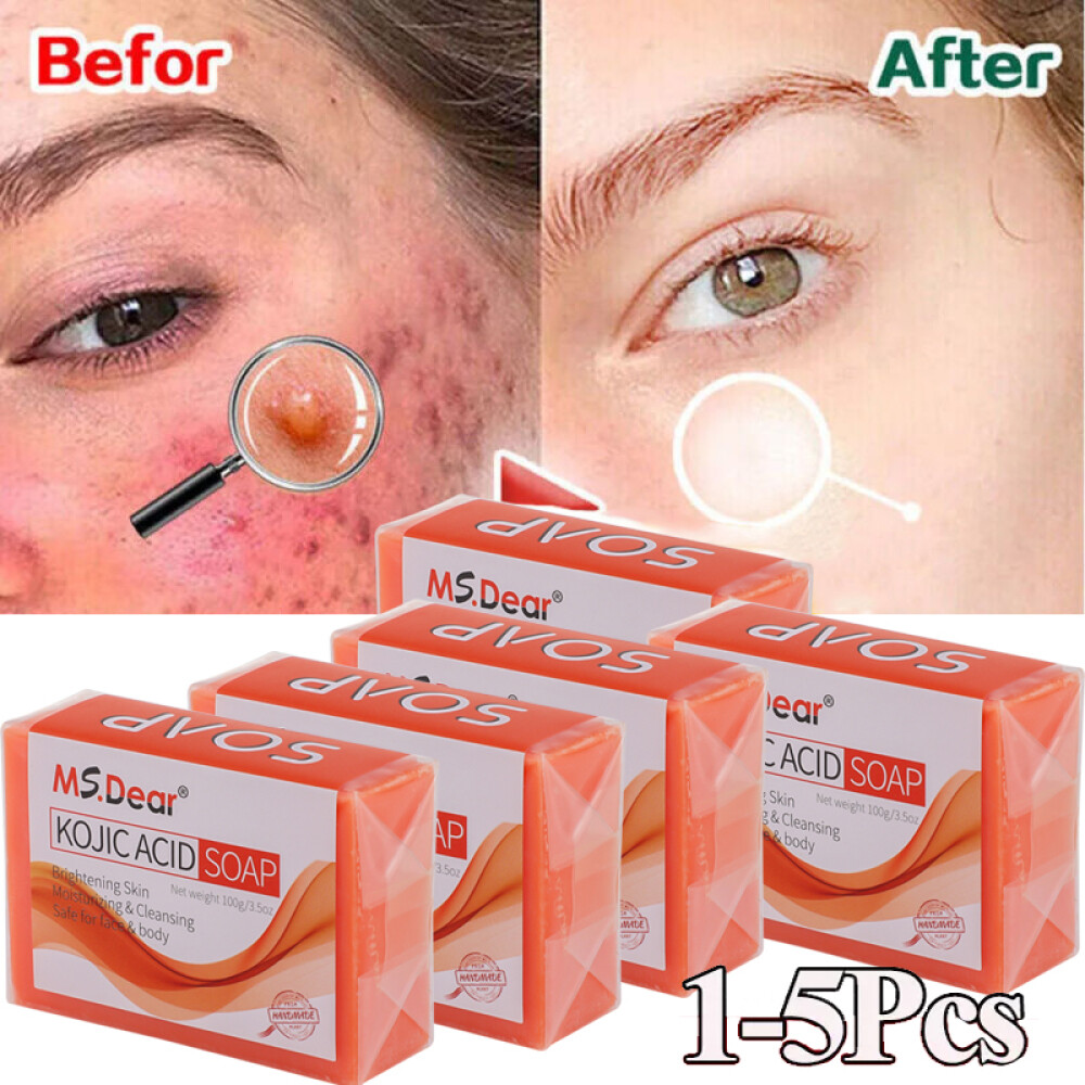 1-5X Kojic Acid Soap Dark Spot Whitening Turmeric Skin Bleaching Lightening 100G