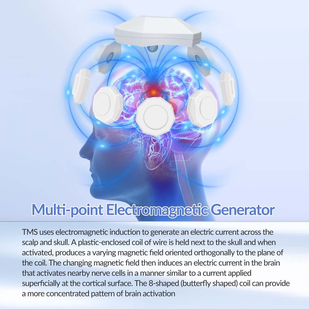 rTMS Transcranial Magnetic Machine for Stroke Depression, OCD & Neurological