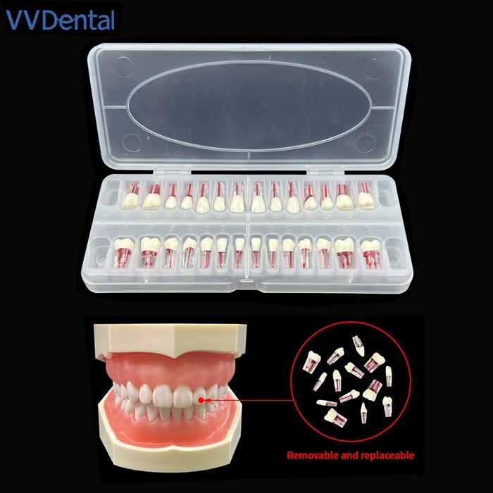 Modelo Acrilico Endodoncia Advanced Root Canal Model Teeth For Rct Practice