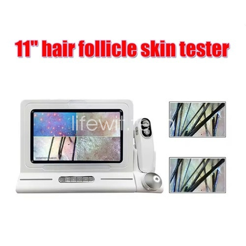 Professional Hot Sale Personal Care Scalp Hair Analysis Hair Follicle Detector