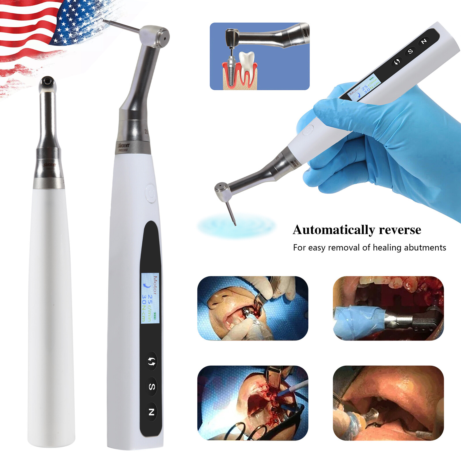 Dental 20:1 Wireless Universal Implant Torque Wrench Electric Driver Kit SANDENT