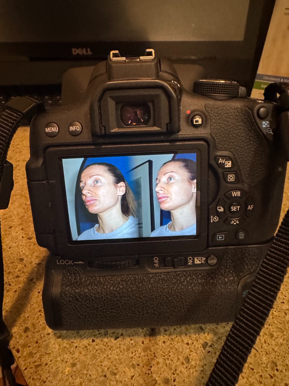 Canfield Vectra H1 3D Digital Imaging Camera