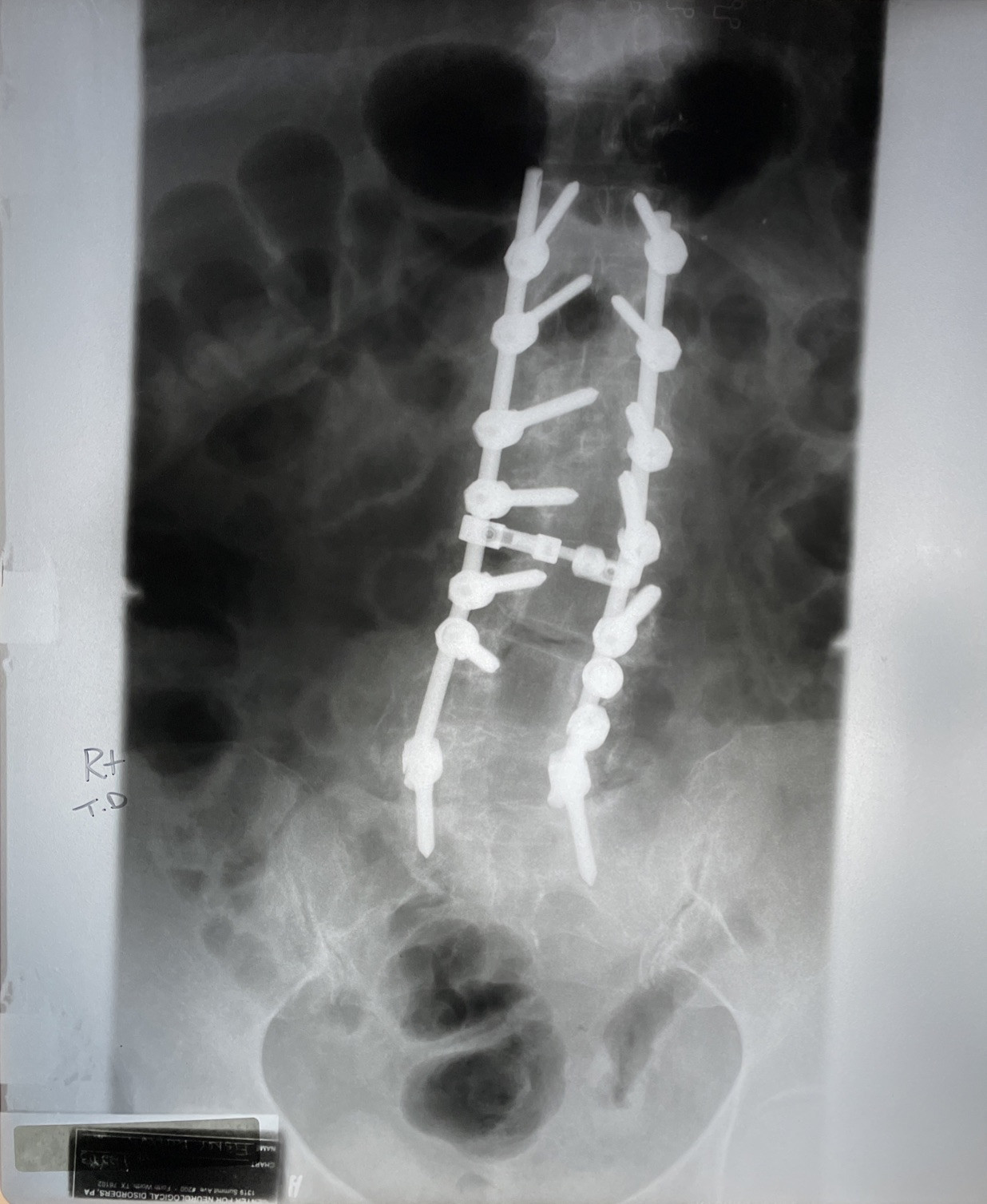 Xray Film Spine X-ray Oddity Medical Teaching Halloween Decor Prop 14x17