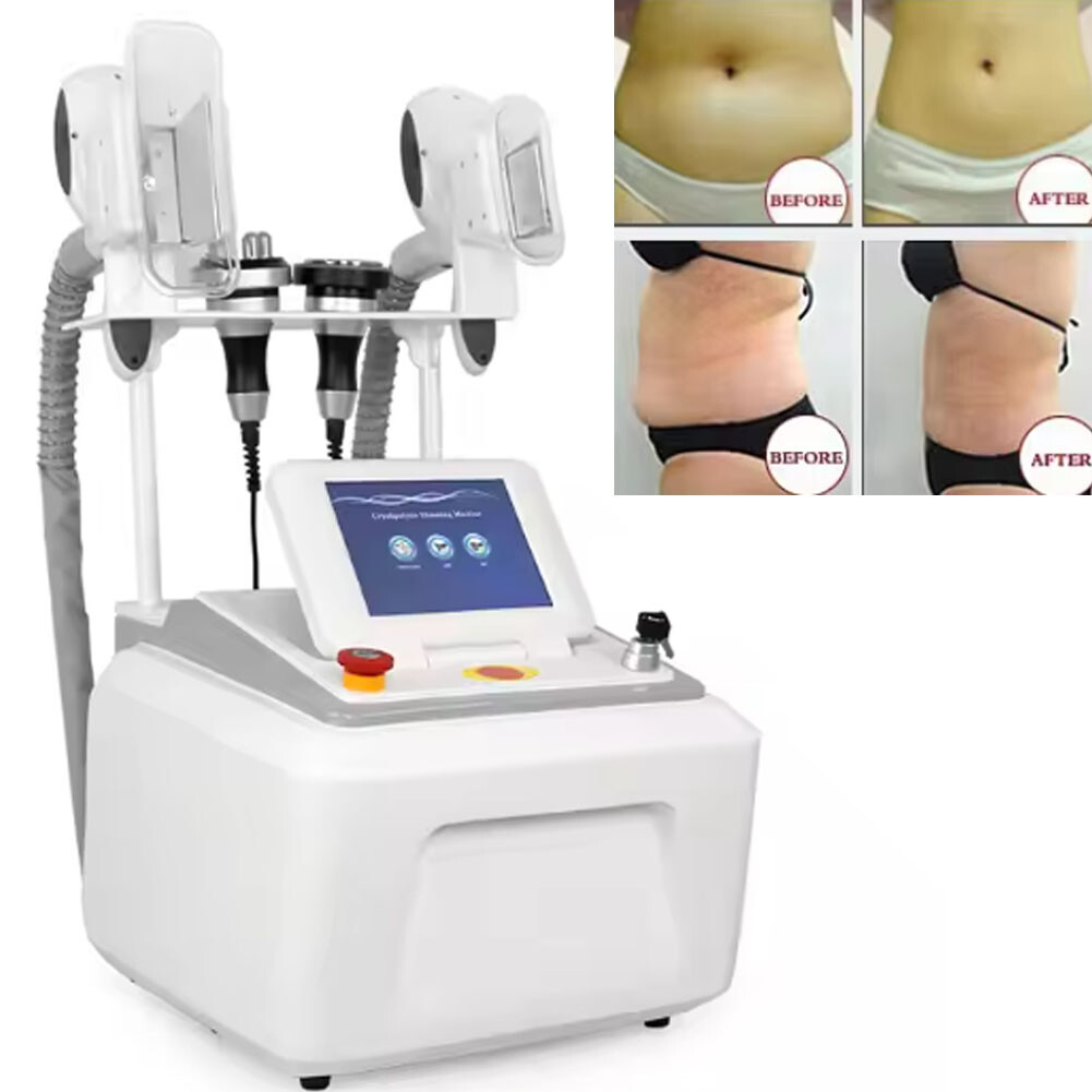 Cryolipolyse Slimming Machine Portable For Home Use Slimming machine