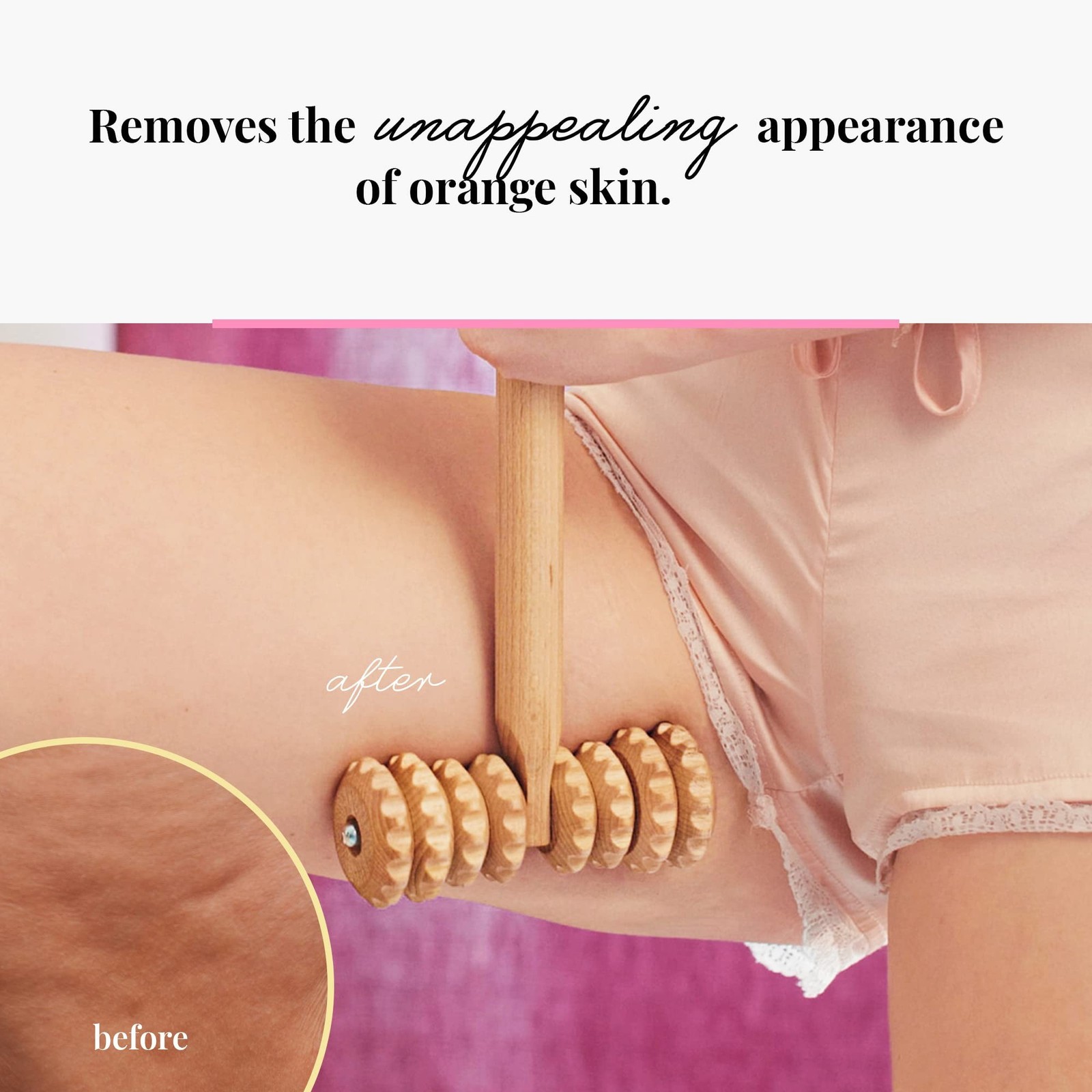 T-Shape Massager with Grooved Rollers, Multi-Functional Body Roller for Cellu...