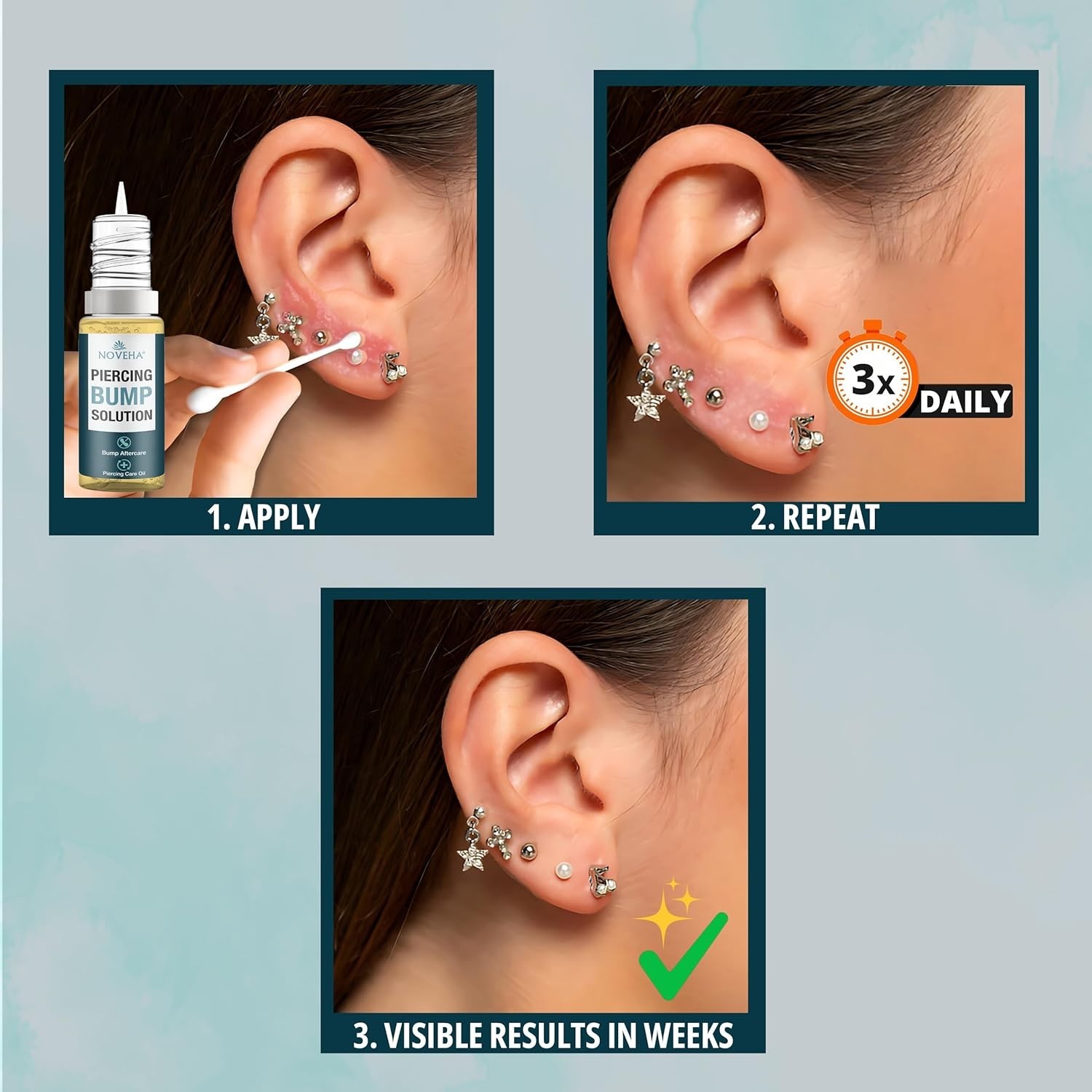 Piercing Bump Solution 20ml for Keloid Reduction | Soothing Solution Tea Tree...
