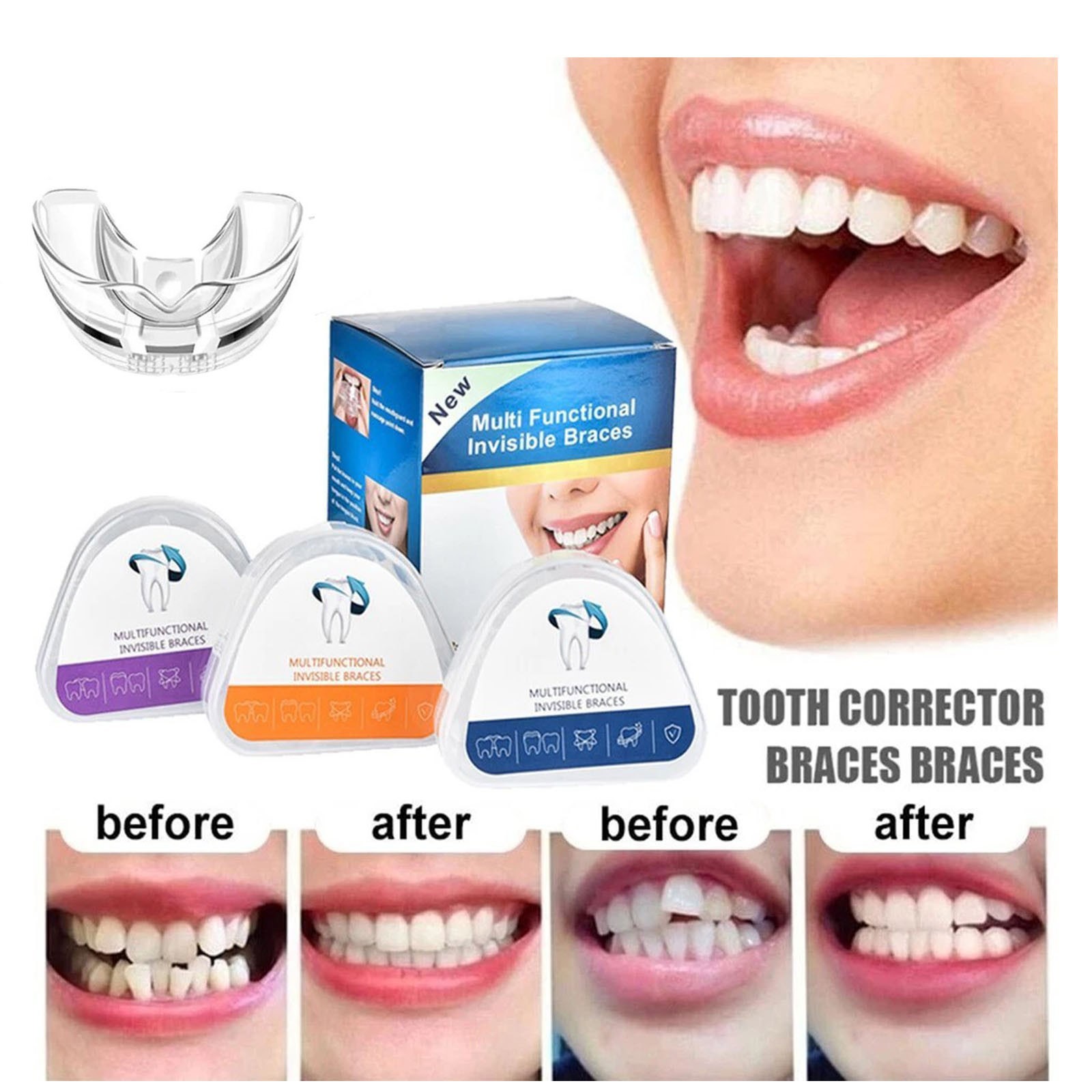 Dental Multifunctional Invisible Braces Orthodontic Teeth Alignment Retainer 1-3