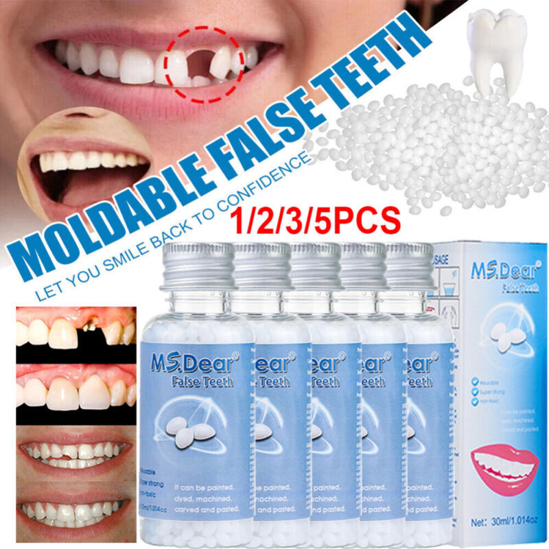 Tooth Repair Kit - Temporary Teeth Replacement Kit for Missing & Broken Teeth