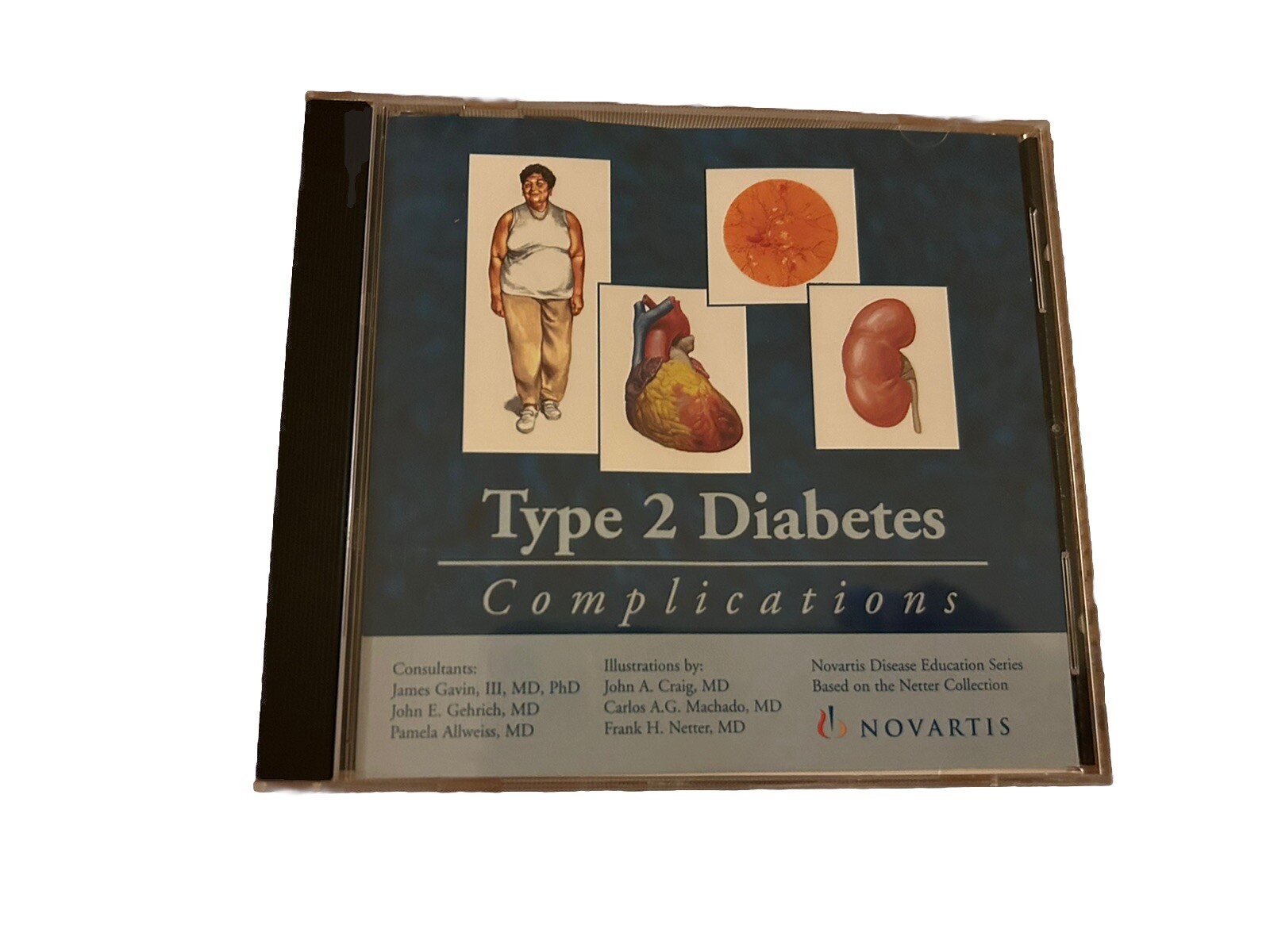 Type 2 Diabetes Complications , Pre-Owned CD-ROM Disc