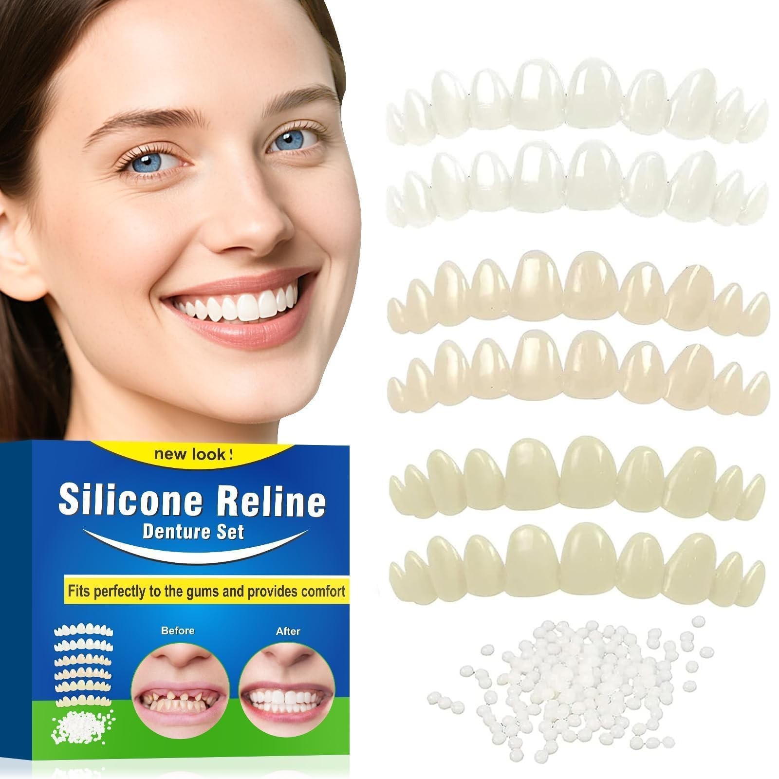Veneers Teeth for Women, Tooth Replacement Missing Teeth, Upper Veneer Cosmet...