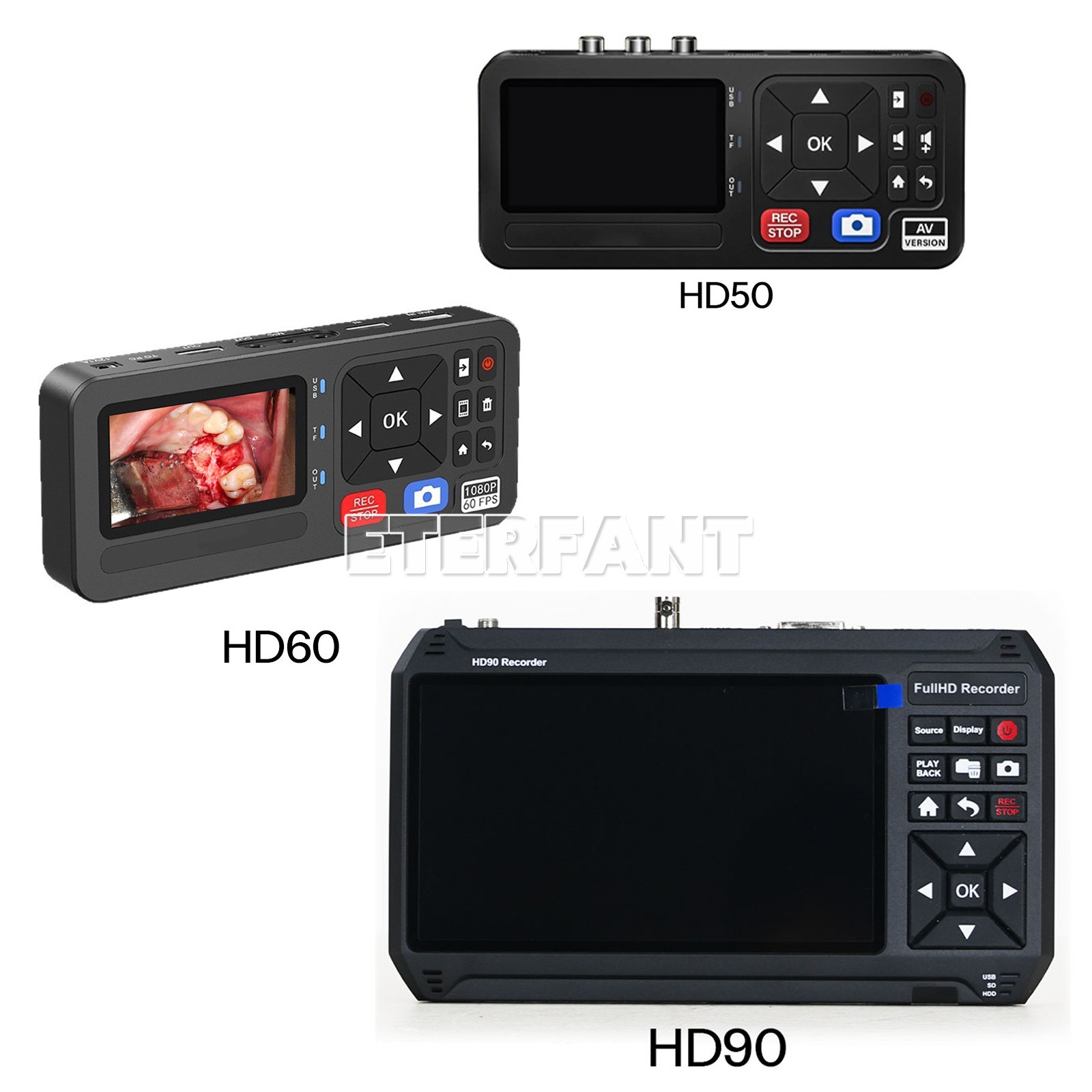 Medical Portable Surgical Recorder Laparoscopy&Endoscopy Capture HD50/HD60/HD90