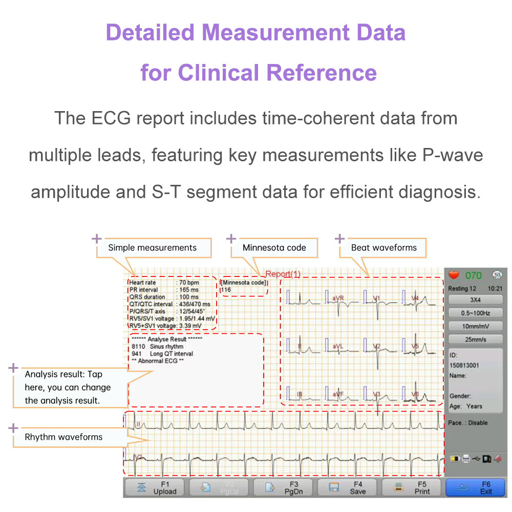 12 channel ECG Machine with interpretation for advisory diagnosis FDA approved