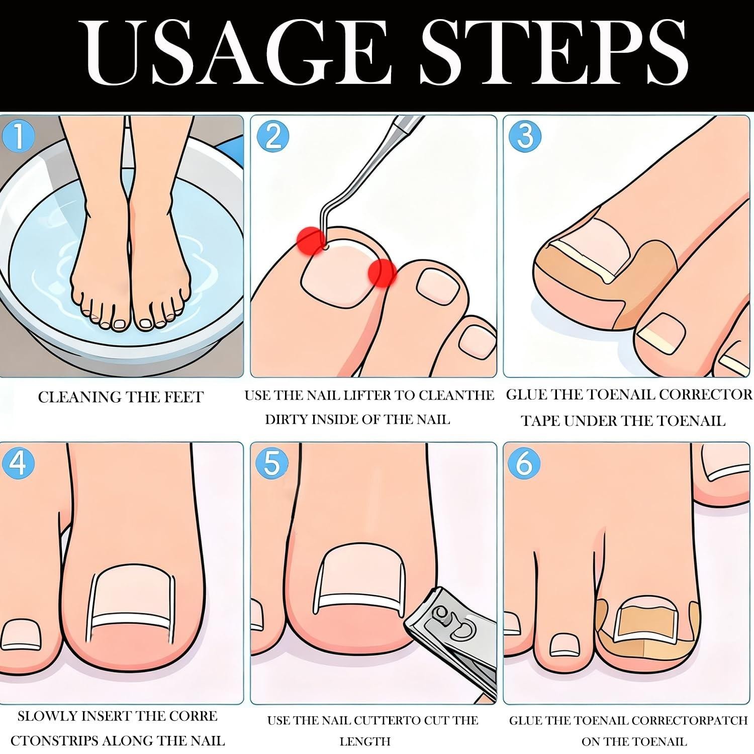 Ingrown Toenail Corrector Set with Correction Strips,professional Ingrown Toe...