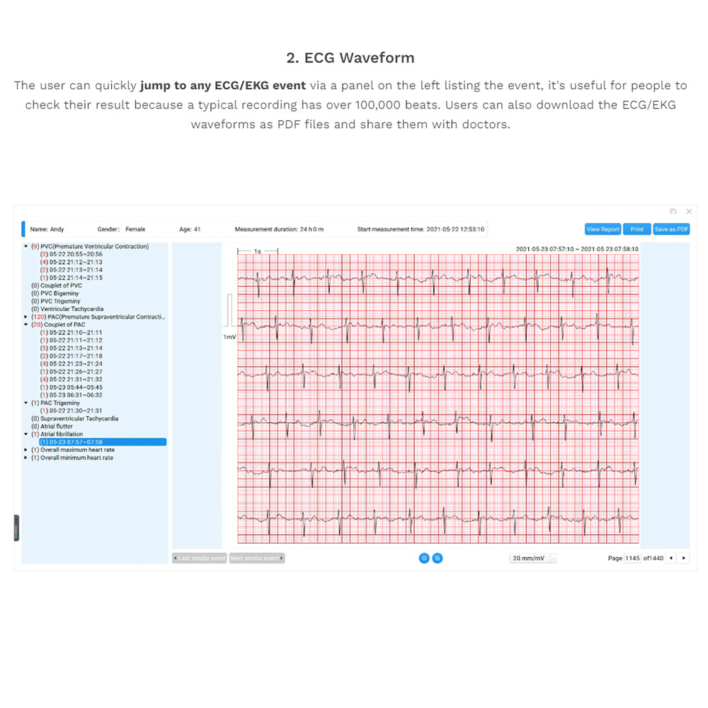 US stock Wellue Portable Dynamic ECG EKG Holter Recorder 24 Hours PC AI analysis