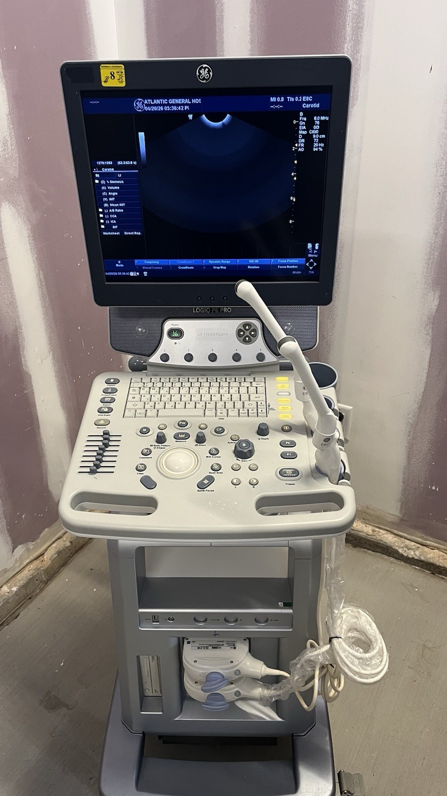 GE E8C-RS Ultrasound Probe Tested 2017