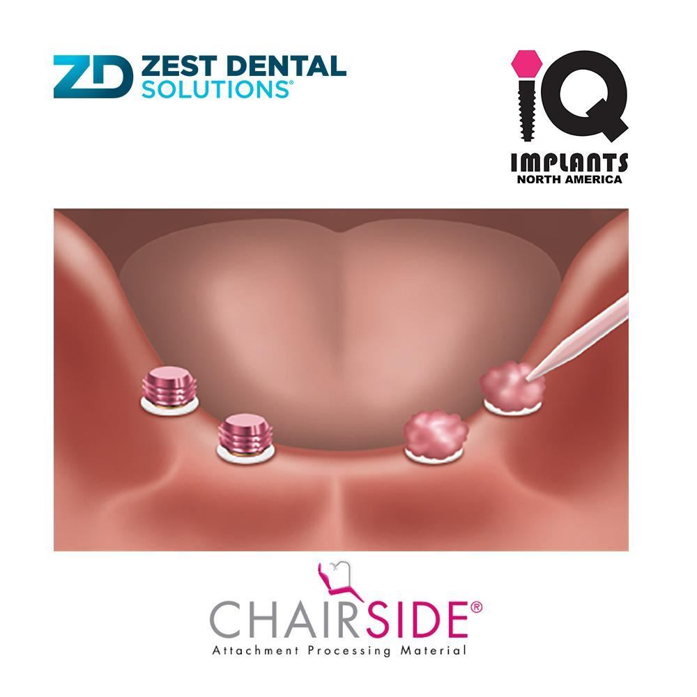 Zest CHAIRSIDE Genuine Attachment Processing Material Fast Set, 8g (4ml)