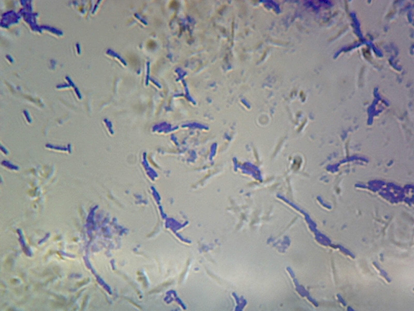 Bacillus Subtilis (Spore Forming); Smear; Gram-Positive