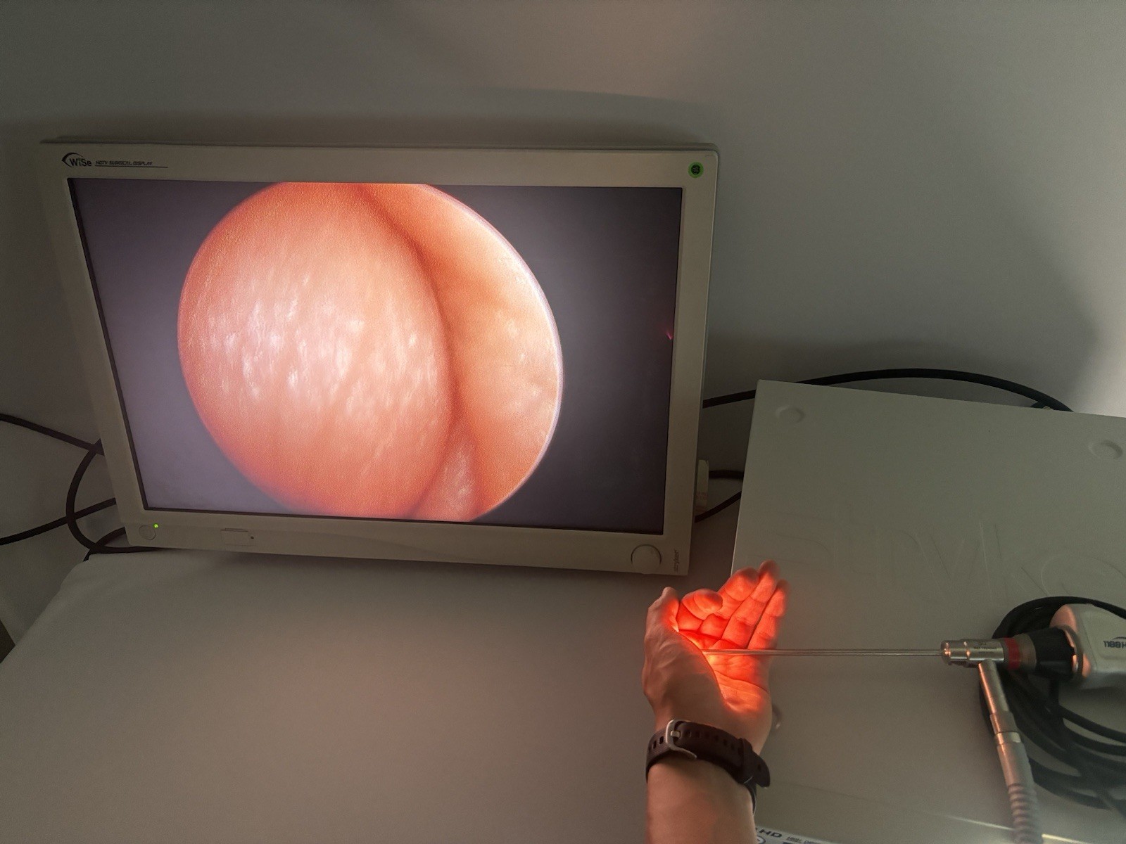 Stryker 1188HD Full System, Camera Console, L9000 Light Source, Camera & Scope