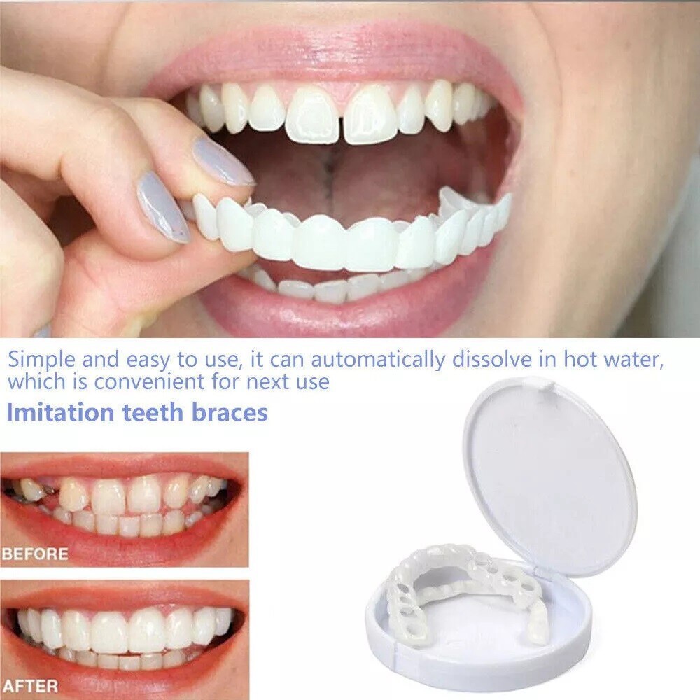 Smile Snap On Upper + Lower False Teeth Dental Veneers Denture Tooth Cover Set