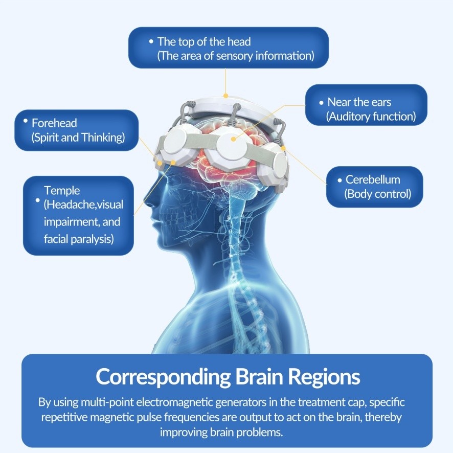 rTMS Therapy Device for Memory Improvement & Sleep Aid