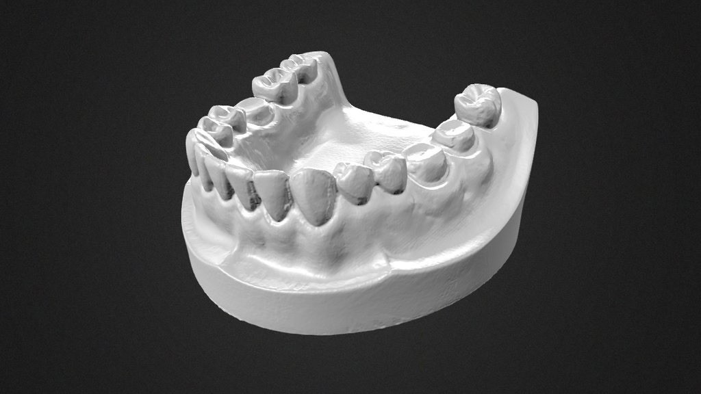 3D DENTAL SCAN SPRAY (12 ea - 1 Box) *Made in Germany (Professional User Only)