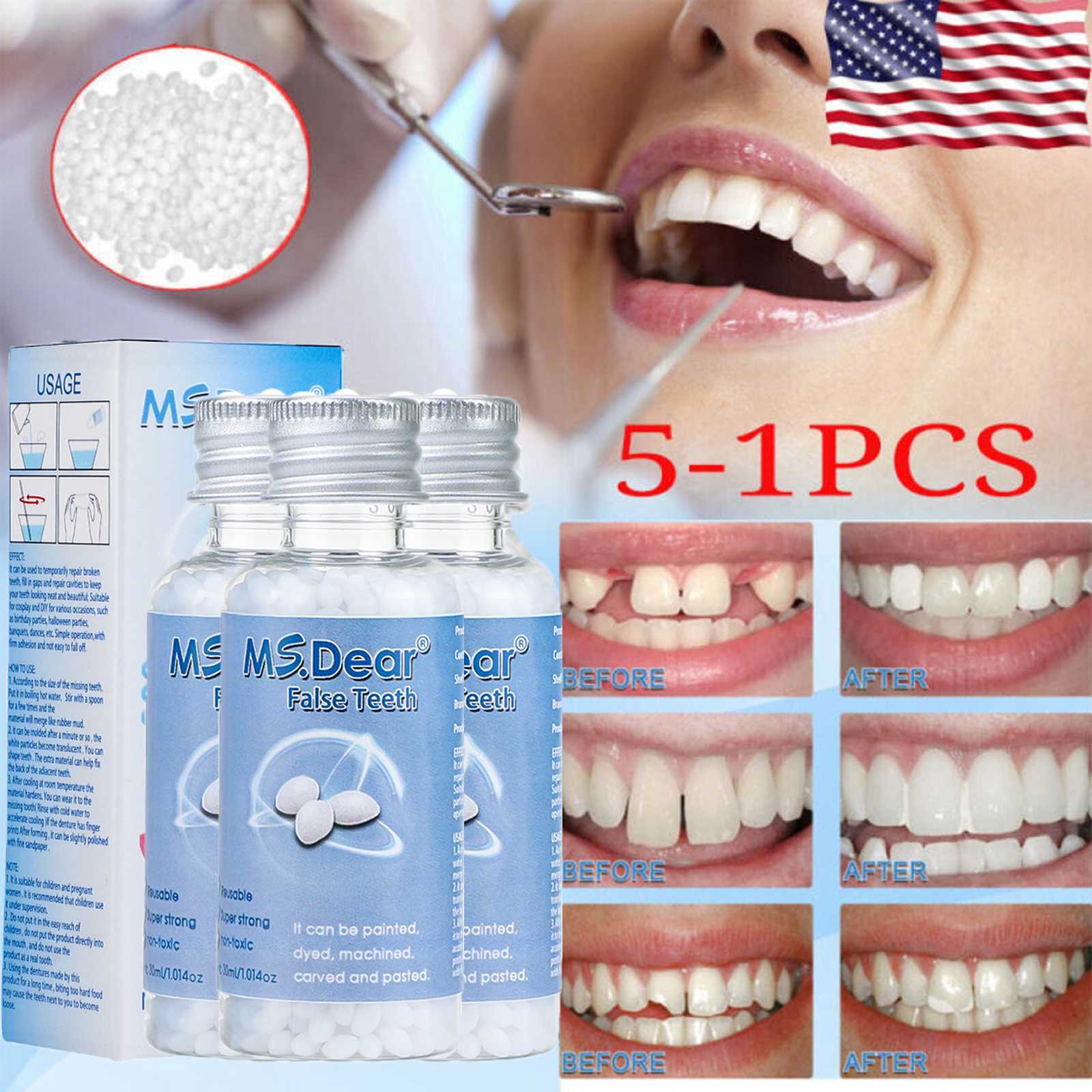 5X Tooth Repair Granules, Temporary Moldable Dental Pellets,Moldable False Teeth