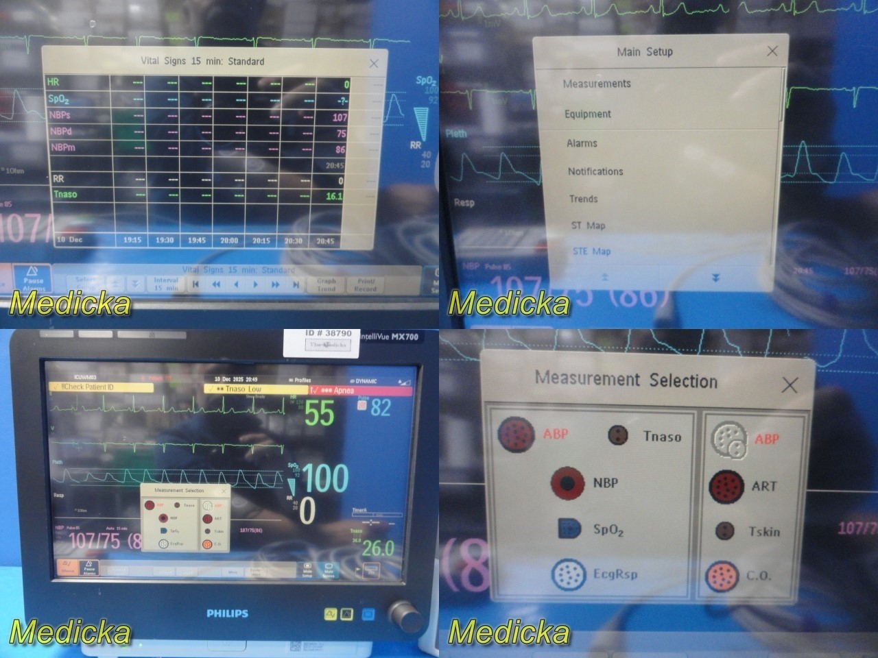 Philips IntelliVue MX700 + X2 (M3002A) + M3012A Monitoring System W/ Leads~38790
