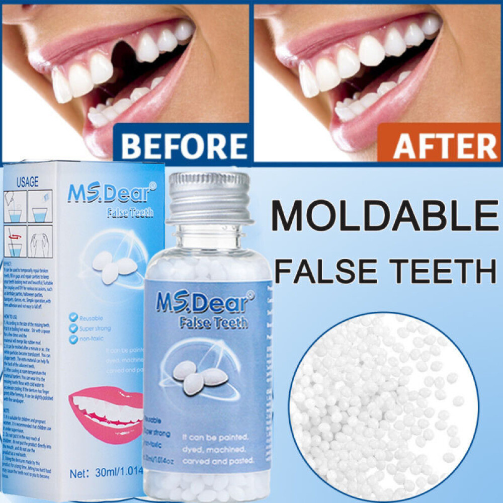 Tooth Repair Granules Temporary Kit Moldable False Teeth Fitting Beads Reusable