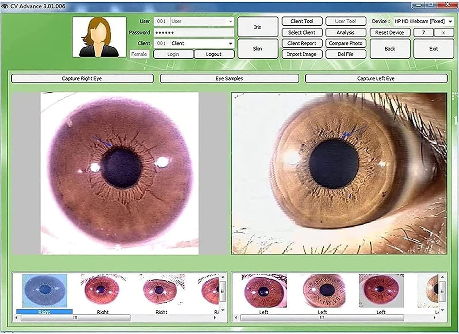 Analyzer Camera HD Iriscope Eye Camera with Analysis Software for Detailed Eye