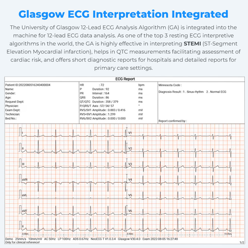 12-Lead ECG Machine Diagnostic Automatic Interpretation data transfer via email
