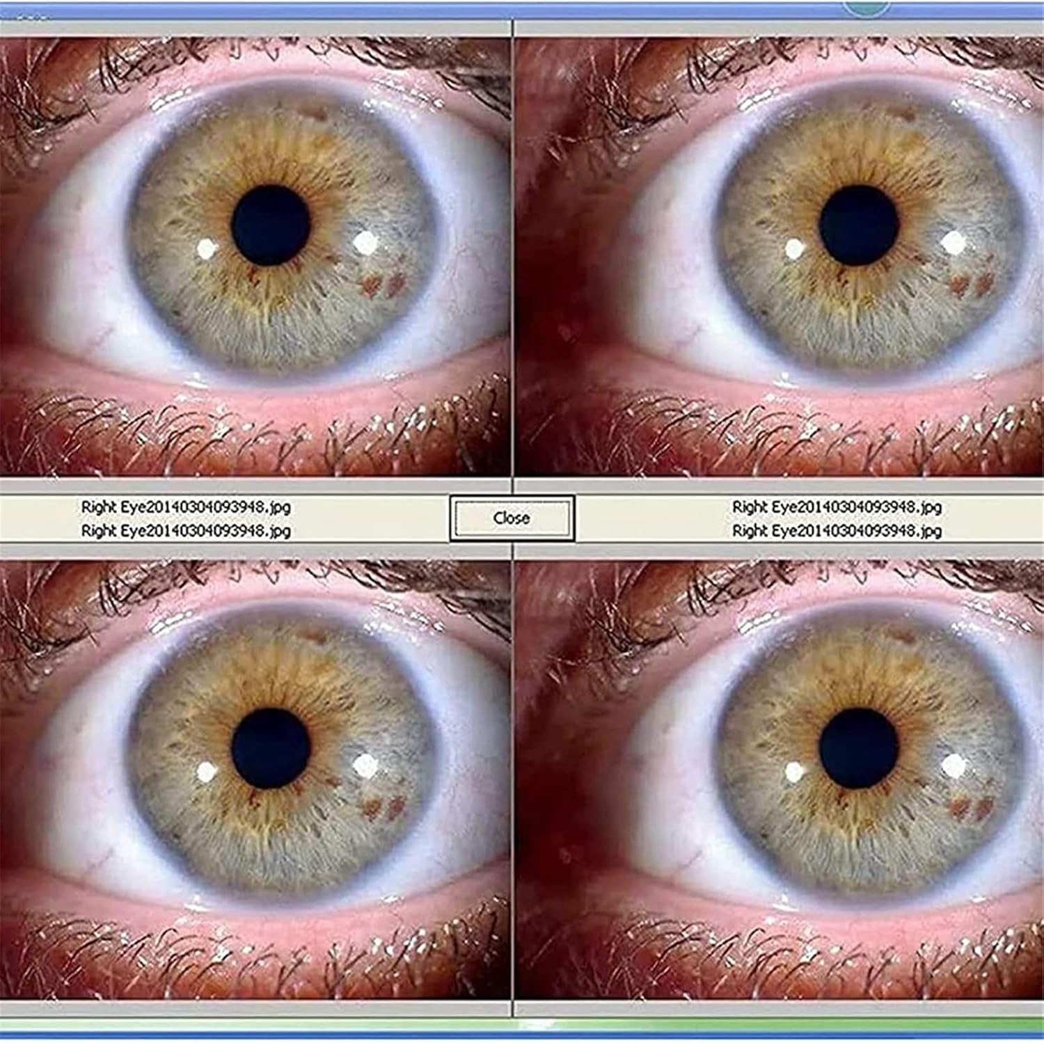 Analyzer Camera HD Iriscope Eye Camera with Analysis Software for Detailed Eye